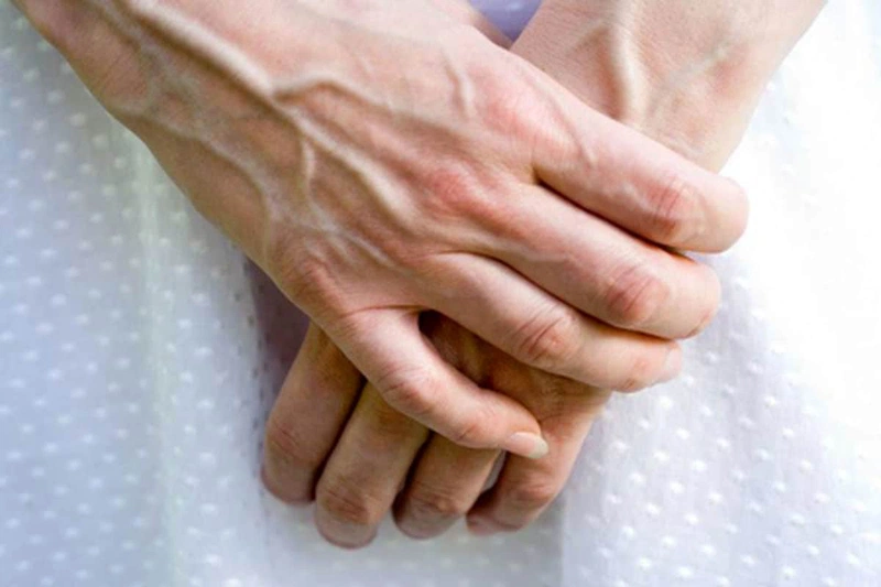 Gân xanh có thể xuất hiện ở nhiều vị trí khác nhau trên cơ thể