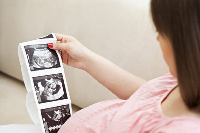Theo dõi huyết áp và các chỉ số sức khỏe tổng quát là cách giúp mẹ bầu 6 tuần kiểm soát tốt trạng thái thể chất trong lúc chờ đợi tim thai - Theo dõi sức khỏe