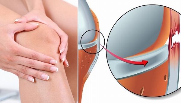 Giãn dây chằng là một chấn thương xương khớp khá phổ biến