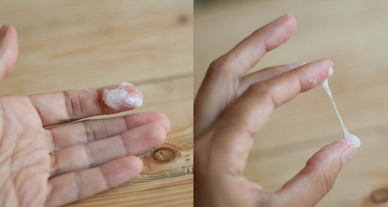 Âm đạo tiết ra khí hư màu trắng sữa có phải mang thai?