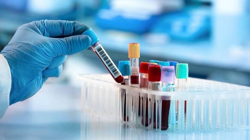 Lối sống lành mạnh và kiểm soát bệnh lý nền giúp bảo vệ hệ thần kinh bền vững 