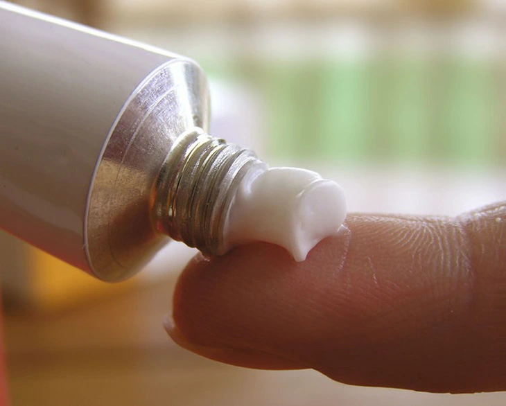 Có thể sử dụng thuốc bôi để điều trị viêm da dị ứng