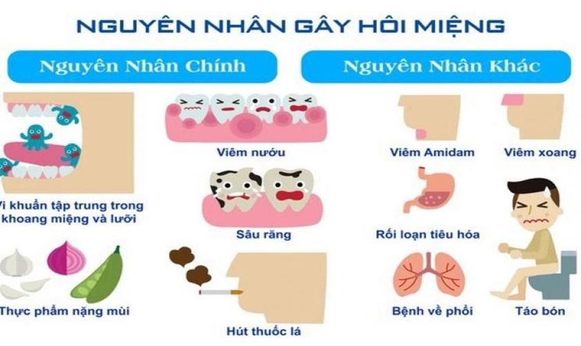 Có nhiều nguyên nhân gây ra tình trạng hôi miệng