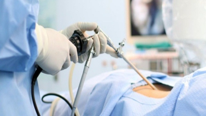 Viêm túi thừa đại tràng nặng cần điều trị phẫu thuật