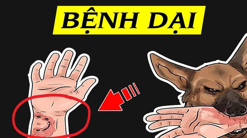 Chủ động tiêm phòng ngay sau khi bị chó mèo cắn để bảo vệ chính mình 
