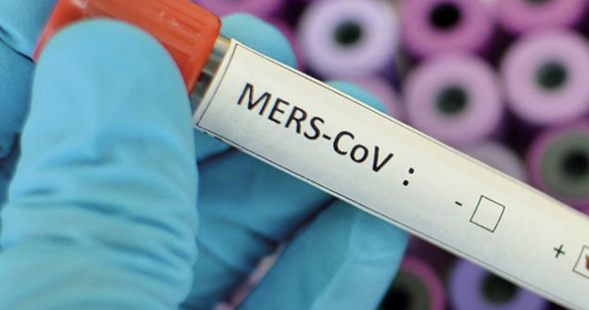 MERS là virus thuộc họ Virus Corona