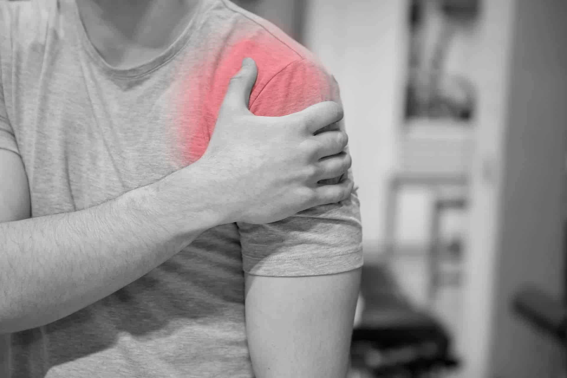 Hình ảnh minh họa trật khớp khi chỏm xương cánh tay bị lệch khỏi ổ chảo, gây đau và mất ổn định khớp