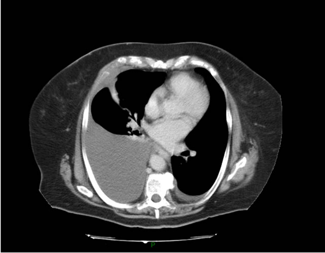 Chụp MRI vùng chậu