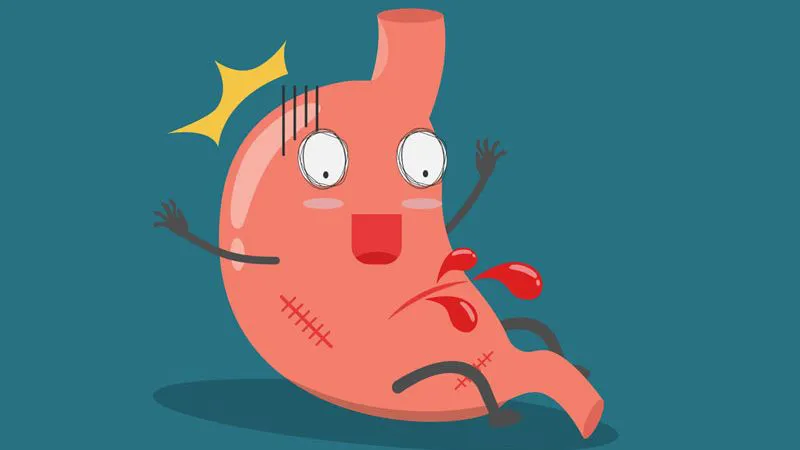 Nôn ra máu là một trong những dấu hiệu điển hình của xuất huyết tiêu hóa trên