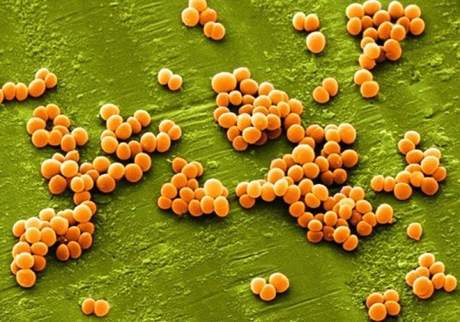 Vi khuẩn Staphylococcus aureus (tụ cầu khuẩn) là tác nhân thường gặp nhất của viêm nang lông