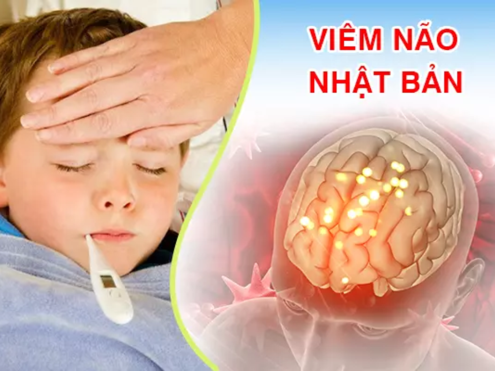 Đừng chủ quan với căn bệnh viêm não Nhật bản