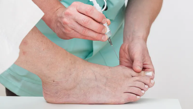 Người bệnh cần mang theo hồ sơ bệnh án và đơn thuốc điều trị gút khi đến phòng khám nghĩa vụ quân sự 