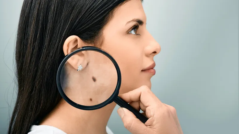 Thay đổi màu sắc da: nguyên nhân, triệu chứng và điều trị