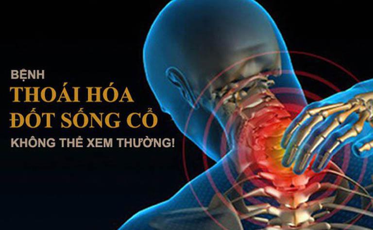 Không thể xem thường bệnh thoát hóa đốt sống cổ