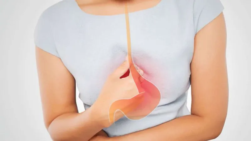 Ợ nóng và ợ chua là những triệu chứng thường gặp của trào ngược dạ dày