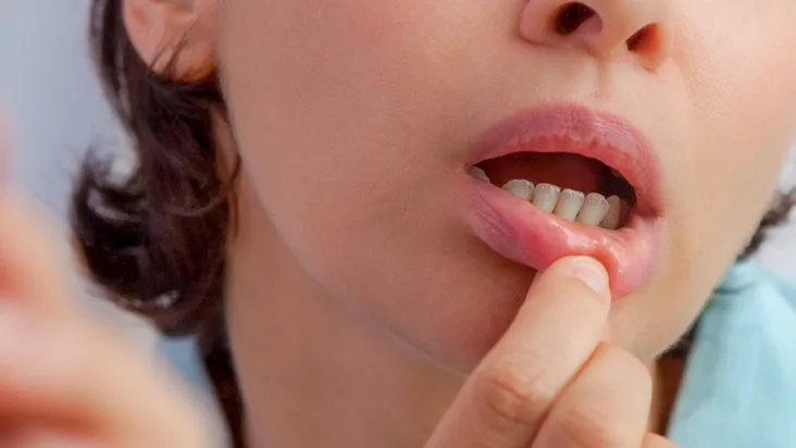 Thăm khám y tế giúp xác định nguyên nhân khi nổi đẹn kéo dài