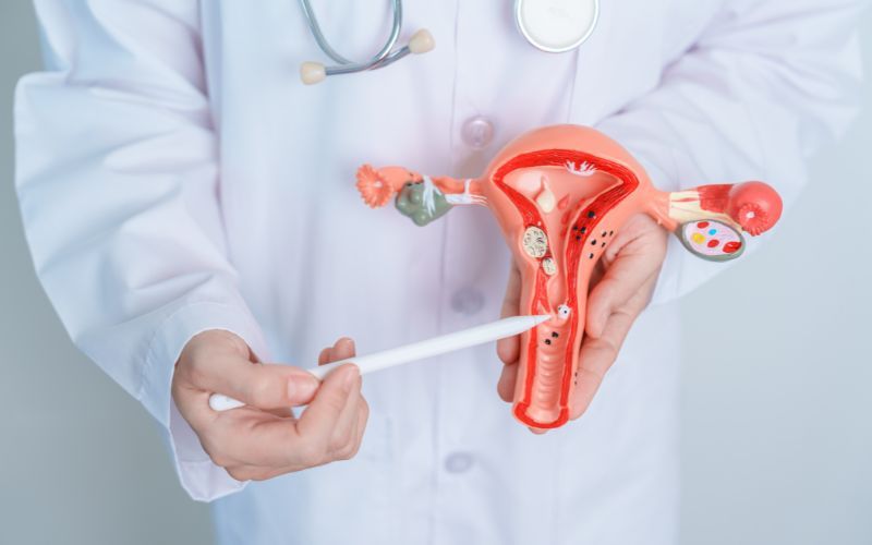 Tầm soát định kỳ giúp phát hiện sớm ung thư biểu mô cổ tử cung 