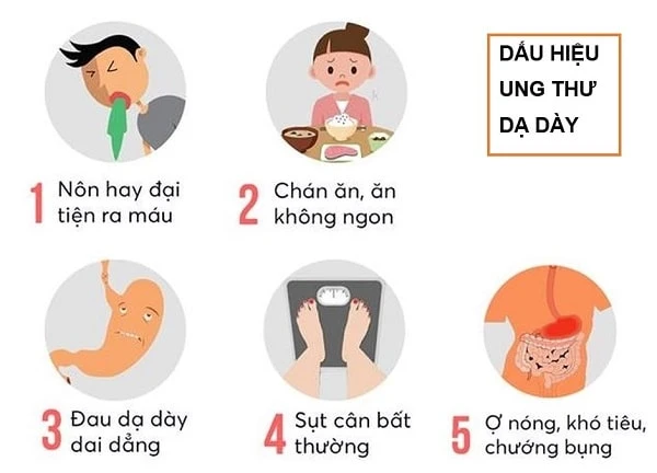 Biểu hiện của ung thư dạ dày