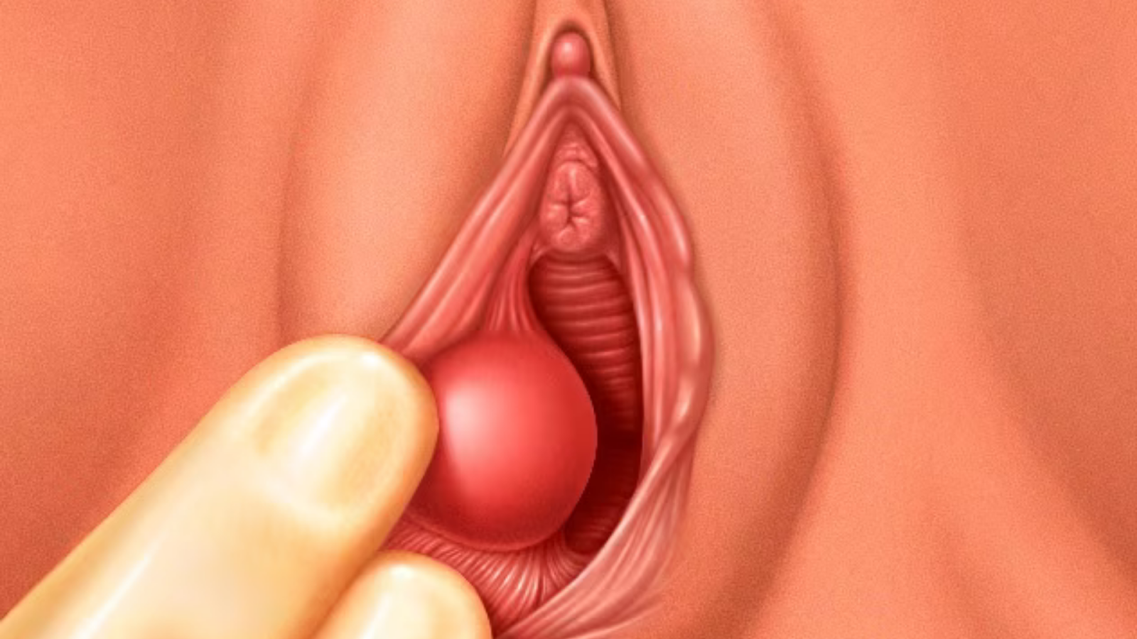 Vùng kín bị sưng một bên mép phải làm sao? Có nguy hiểm không?