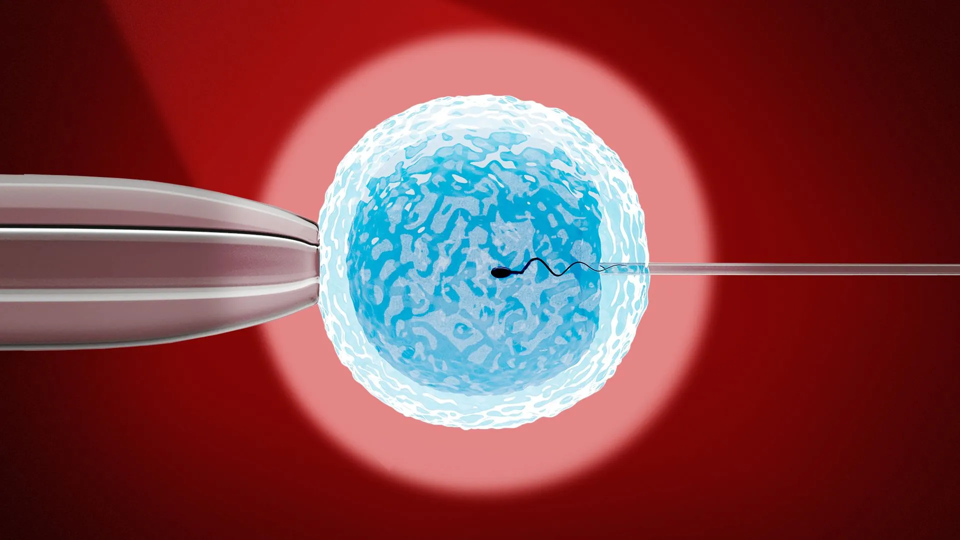 Thụ tinh trong ống nghiệm IVF