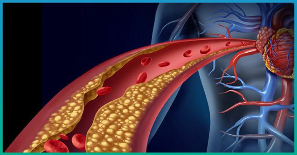 Tổng quan về cấu trúc tim