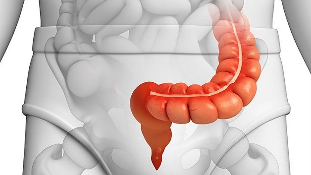 Đại tràng sigma có thể gặp nhiều bệnh lý tiêu hóa khác nhau
