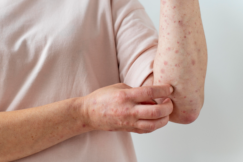 Minh hoạ về các bước của phẫu thuật Mohs