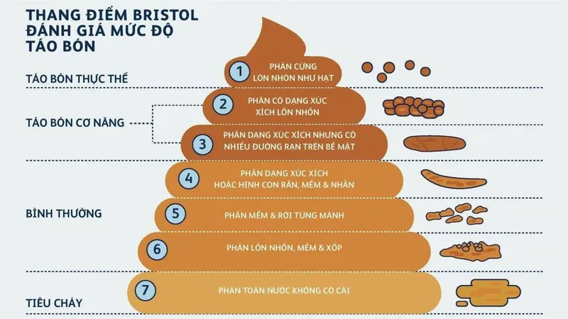 Hình minh họa thang phân Bristol giúp phân loại hình dạng phân để đánh giá sức khỏe hệ tiêu hóa