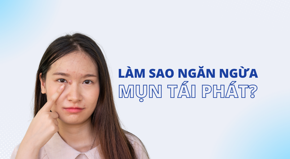 DỨT ĐIỂM TÌNH TRẠNG MỤN TÁI ĐI TÁI LẠI?