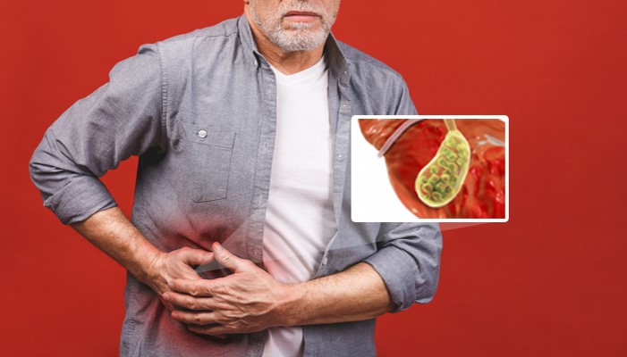 Triệu chứng mắc bệnh sỏi túi mật đa số là đau âm ỉ dưới sườn phải