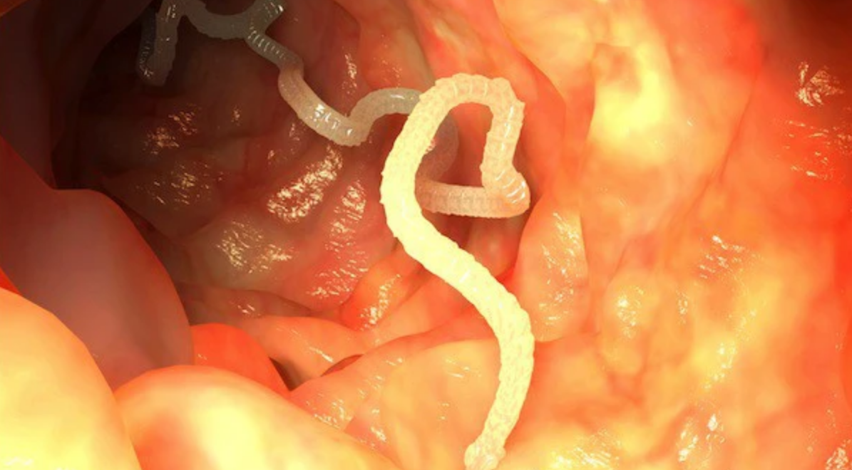 Nhiễm sán dây: Tác hại của nhiễm sán dây đối với sức khỏe