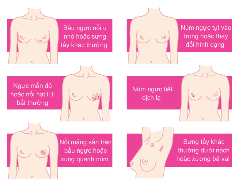 Dấu hiệu nhận biết ung thư vú
