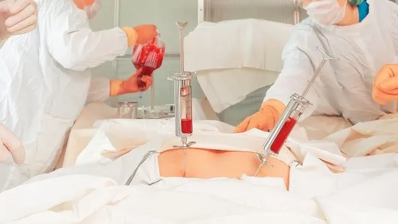 Minh hoạ về ghép tuỷ là phương pháp hiện đại điều trị ung thư 
