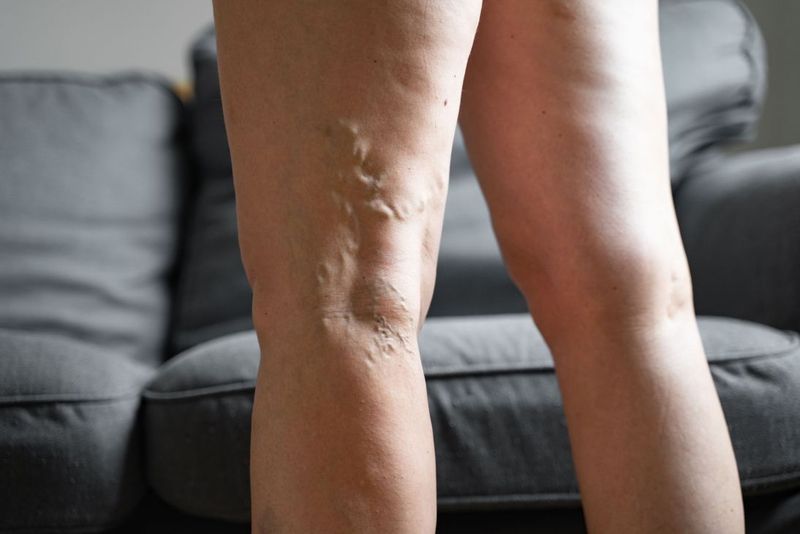 Hình minh họa xoa bóp chân nhẹ nhàng có thể giúp giảm cảm giác nặng chân