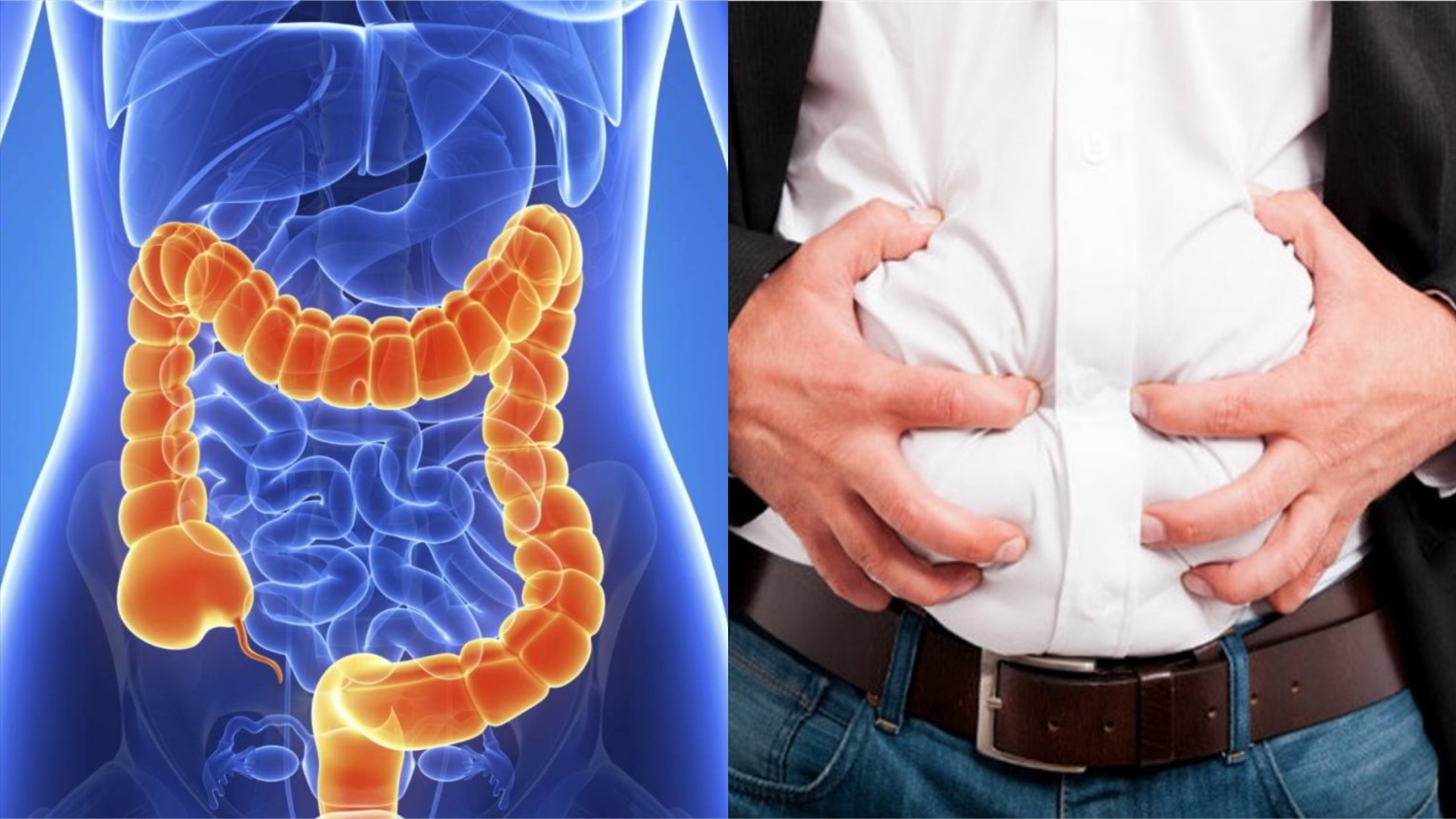 Hiểu rõ về ung thư ruột kết: triệu chứng, nguyên nhân và ...