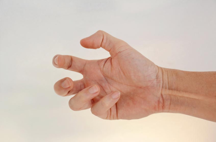 Không dùng thuốc Basocholine cho người bị tăng trương lực cơ thần kinh đối giao cảm