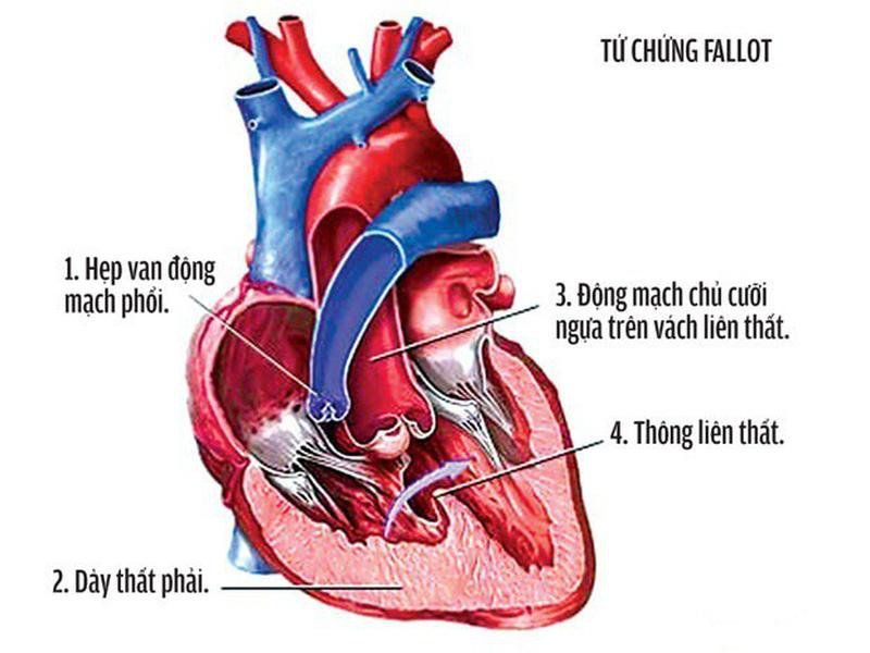 Minh hoạ về kiểm tra tình trạng sức khoẻ ngay giai đoạn sơ sinh