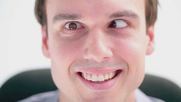 Chẩn đoán chính xác nguyên nhân là chìa khóa để điều trị liệt vận nhãn hiệu quả