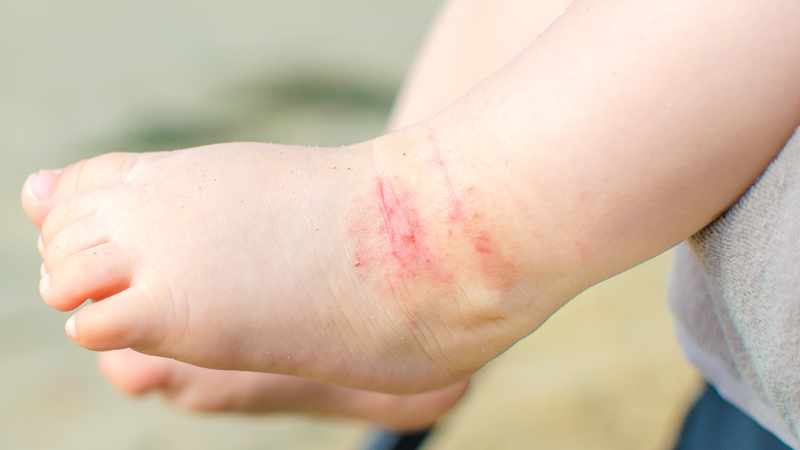 Dược sĩ Pharmacity tư vấn giải pháp làm sạch da chân dịu nhẹ