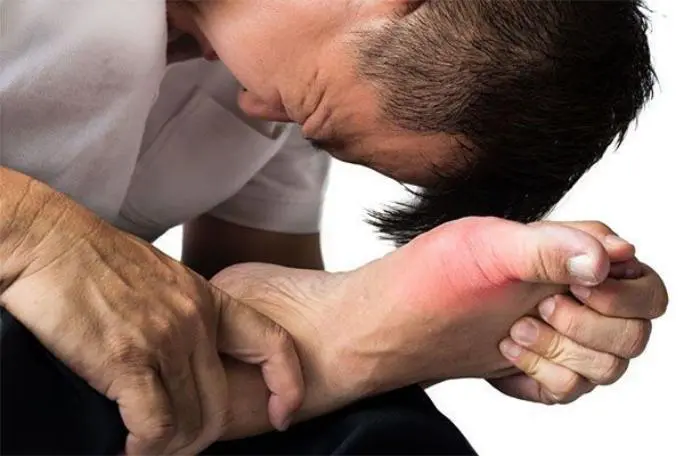 Bệnh gout mạn tính khiến người bệnh đau đớn.