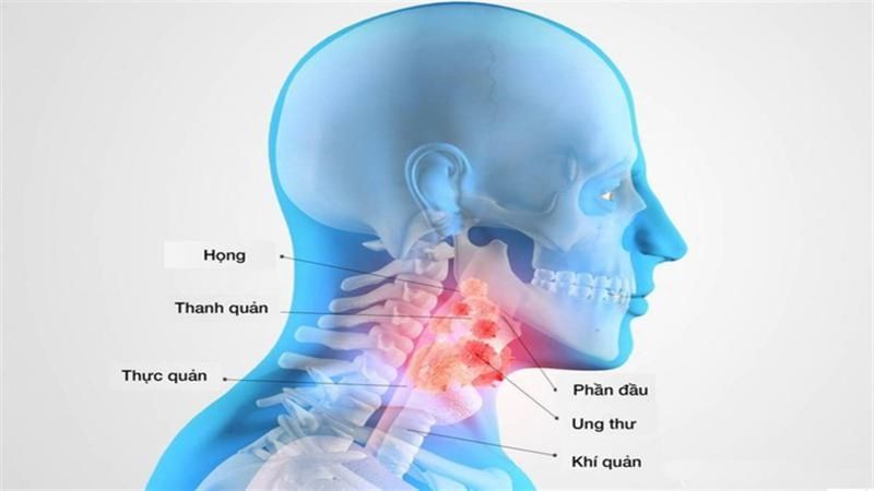 Việc xác định chính xác giai đoạn bệnh giúp bác sĩ đưa ra phác đồ điều trị hiệu quả nhất
