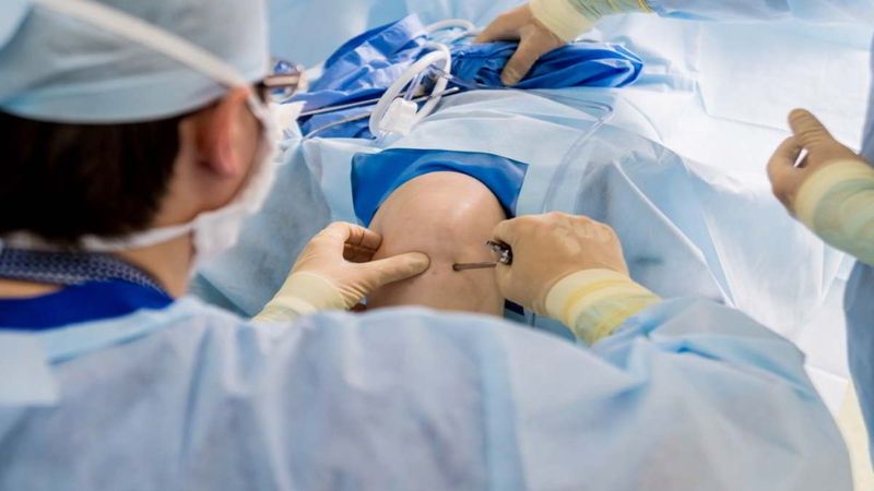Phục hồi chức năng đóng vai trò quan trọng sau phẫu thuật dây chằng đầu gối