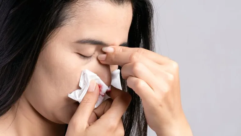 Minh họa tư thế ngồi thẳng và bóp cánh mũi để sơ cứu chảy máu cam đúng cách tại nhà