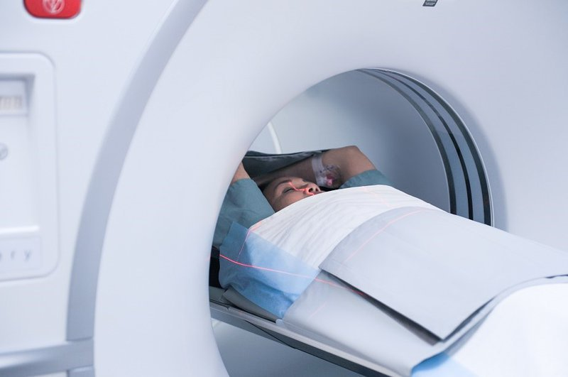 Bụi phổi atbet (amiăng) có thể chẩn đoán bằng phương pháp chụp cắt lớp vi tính