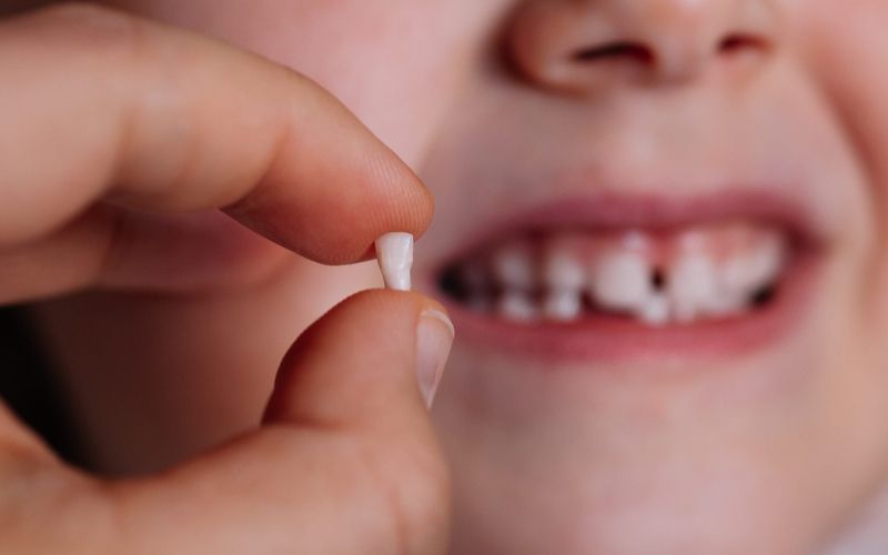 Sau khi nhổ răng sữa vứt ở đâu: lựa chọn và quyết định của bạn