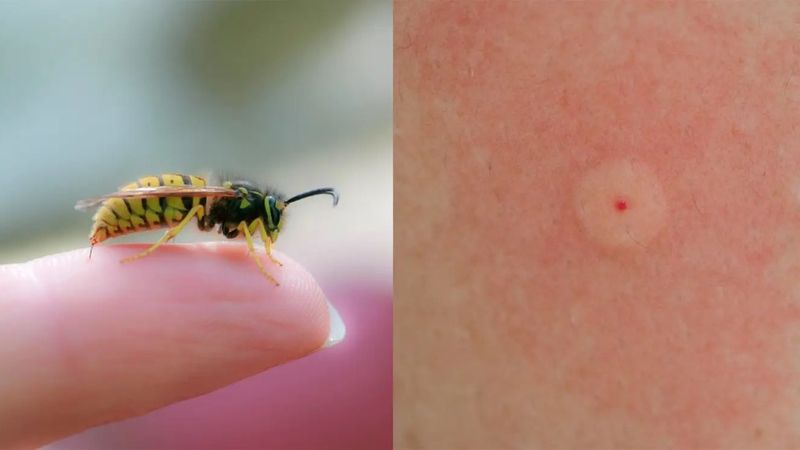 Vết ong đốt thường gây sưng đỏ, đau rát và có thể khiến vùng da bị đốt trở nên nhạy cảm trong vài ngày.