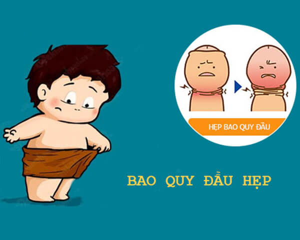 Hẹp bao quy đầu.