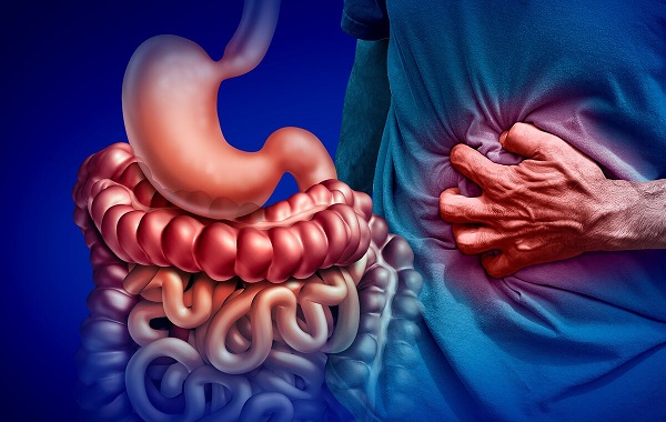 Bệnh Crohn còn được gọi là bệnh viêm ruột mạn tính từng vùng