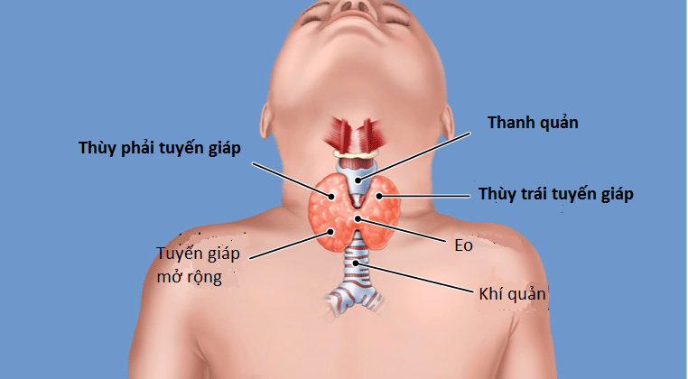 Tìm hiểu những triệu chứng phổ biến của bệnh cường giáp và những kiến thức quan trọng giúp bạn nhận biết, điều trị và phòng ngừa hiệu quả.