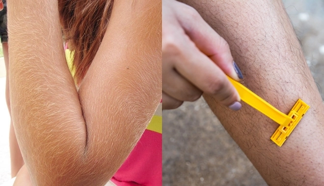 Bệnh “người sói” là vô phương cứu chữa